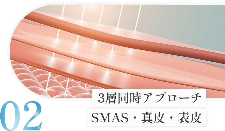 3層同時アプローチ SMAS・真皮・表皮